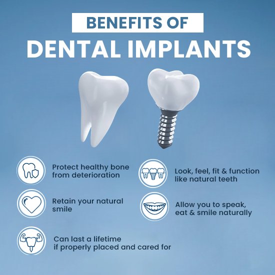 benefits-of-dental-implants-over-dentures