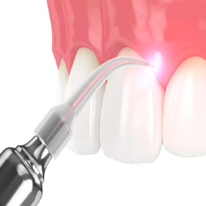 best-laser-dental-clinic-in-hyderabad-drjaydev-dental